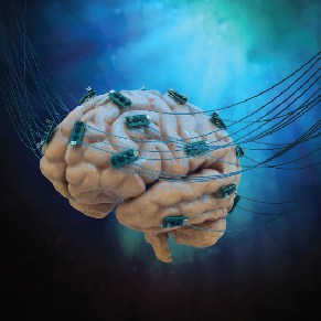 All you need to know about Deep Brain Stimulation 